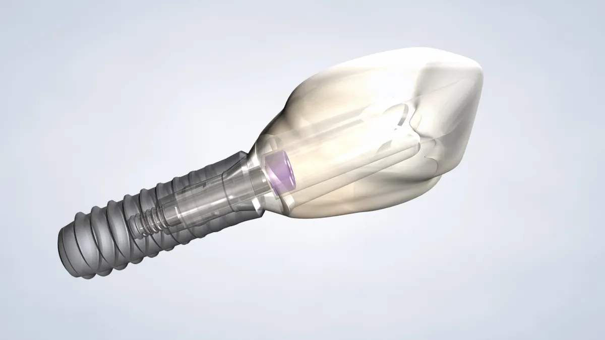 How to Know if Dental Implants are Right for You